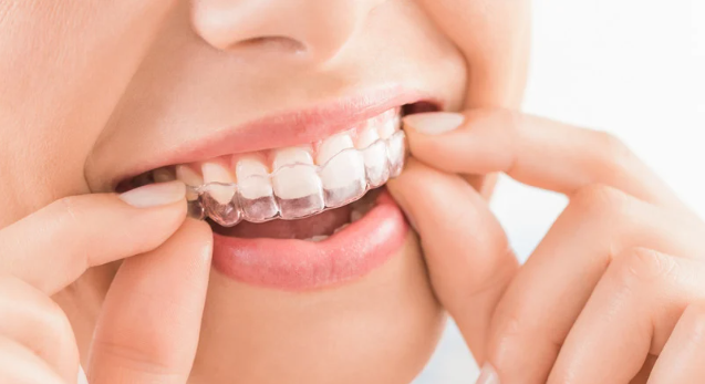 orthodontic treatment orthodontic treatment